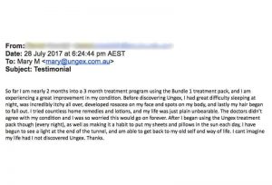 2-ungex-review-testimonial-demodex-treatment | Ungex