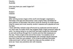 4-ungex-review-testimonial-demodex-treatment | Ungex