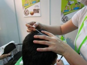 Cosmobeaute-mite-solutions-hairloss-22-960x300 | Ungex | Demodex