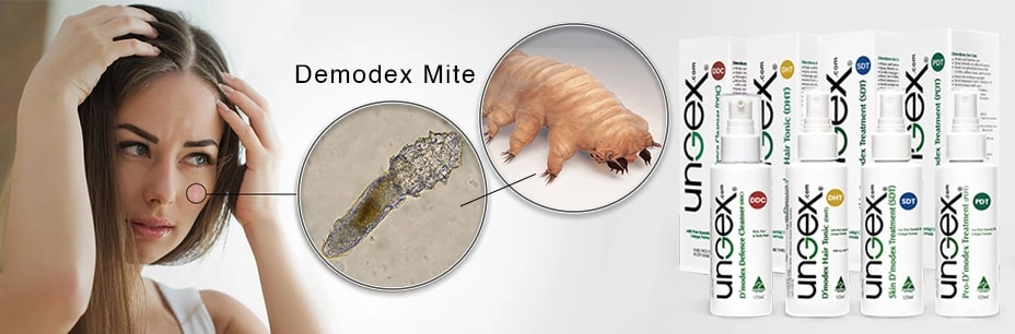 Demodex mite Treatment | Ungex