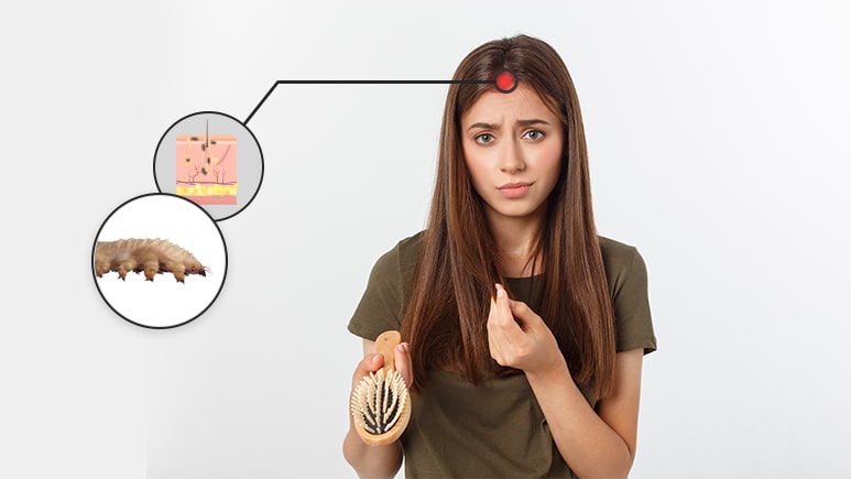 What Do Demodex Hair Mites Look Like | Ungex