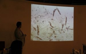 arab-health-hairloss-mite-7-960x600_c | Ungex | Demodex
