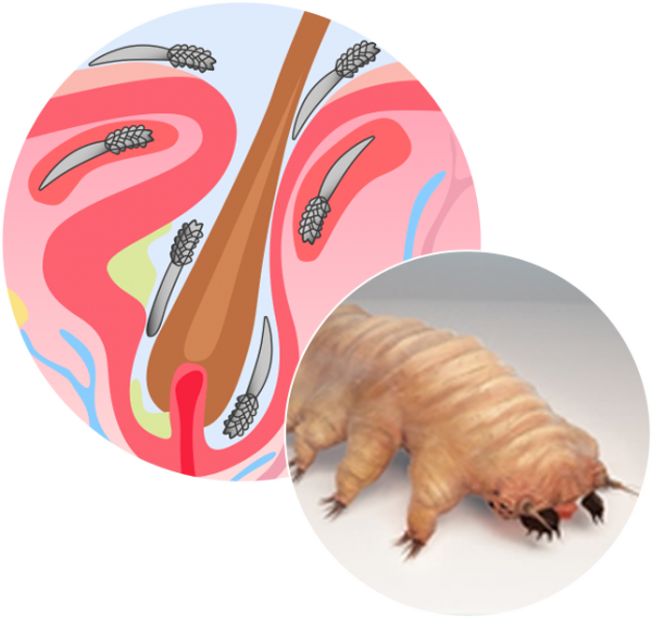 More About Mites Ungex Human Hair Mite Demodex Treatment
