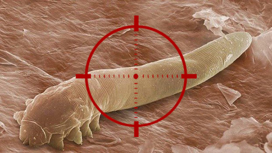 Target Demodex Mites | Ungex