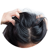itching1 | Ungex | Demodex