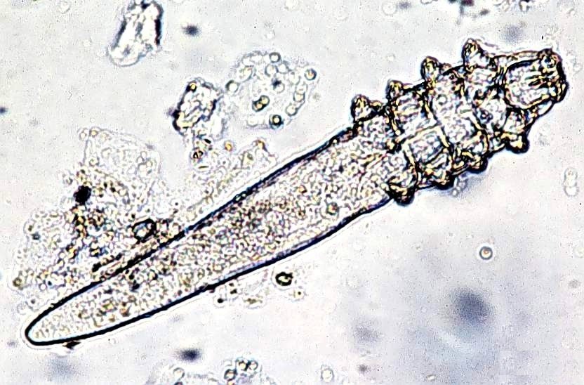 Microscopic mite | Ungex
