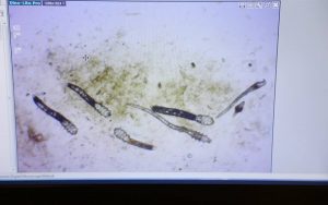 salon-melbourne-mite-test-hairloss-3-960x600_c | Ungex | Demodex