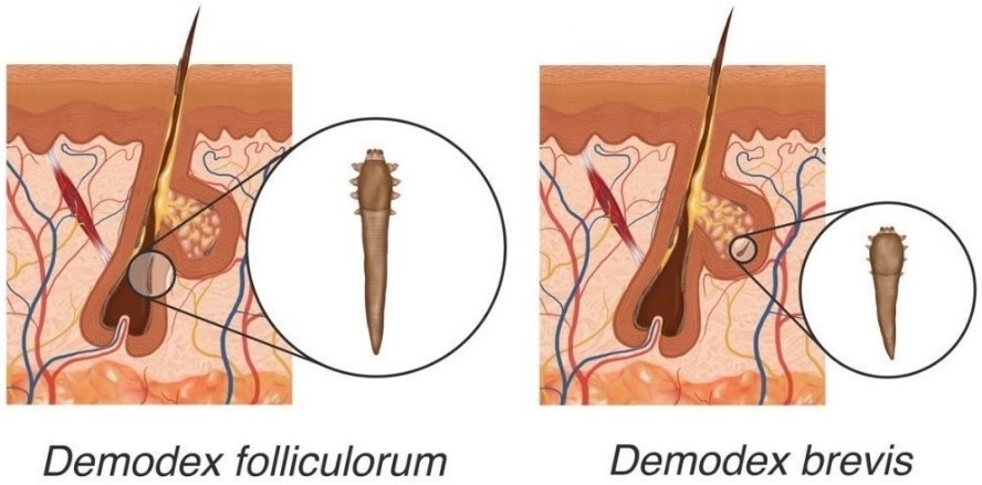 human hair hair follicle parasite