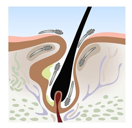 follicle mites | Ungex