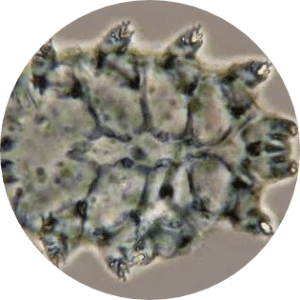 Demodex Mites Png | Ungex