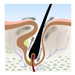 demodex cute ungex