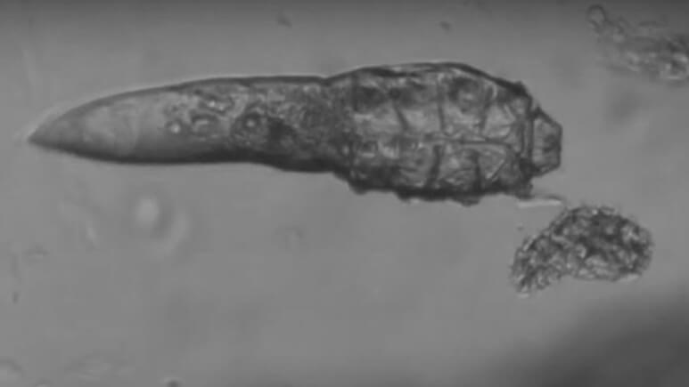 Demodex brevis | Ungex