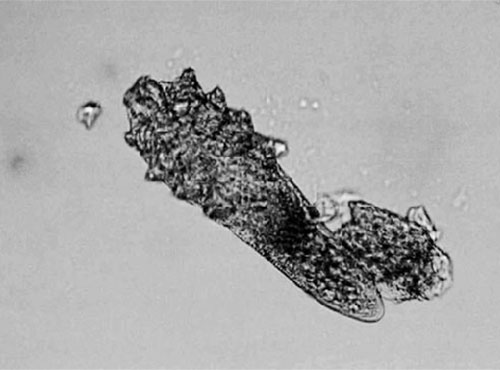 Demodex Brevis under microscop | Ungex