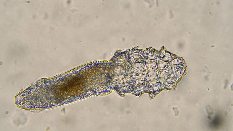 Demodex Mites Under The Microscope | Ungex