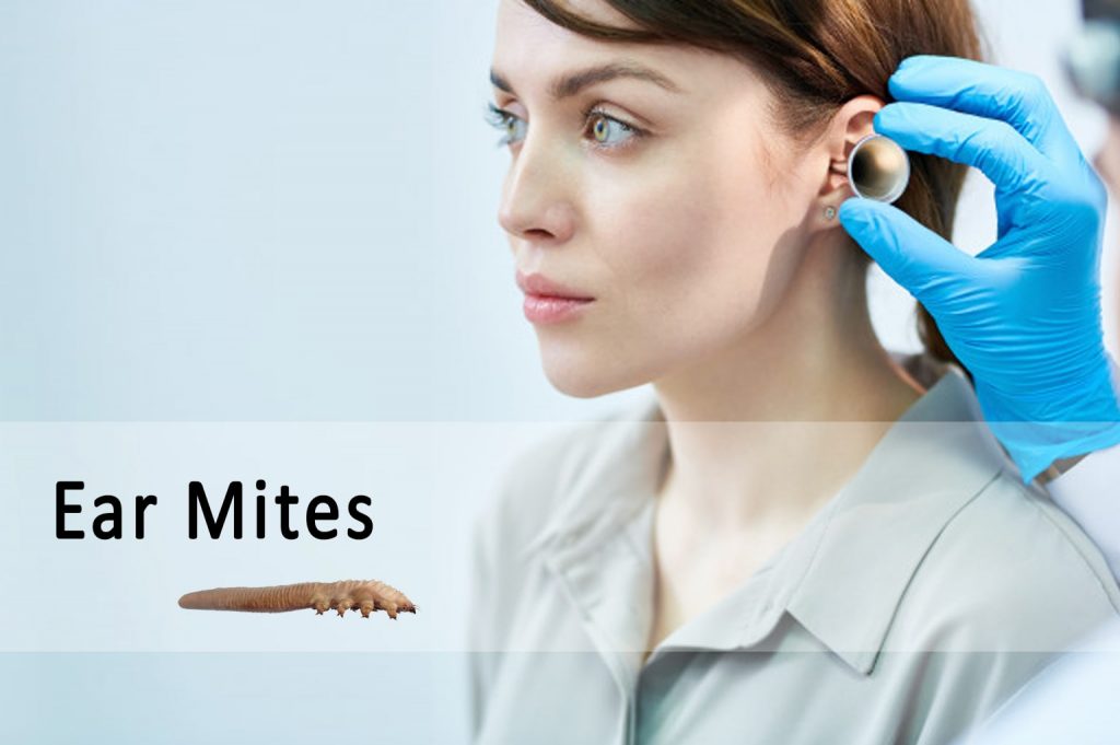 ear mites in humans | Ungex
