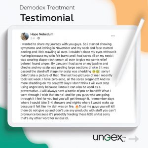 Testimonial | Ungex