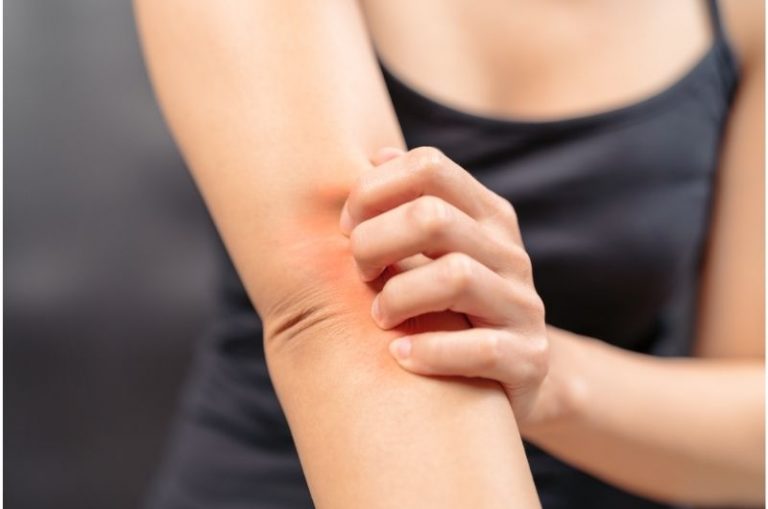 What Causes Burning Sensations? Ungex Demodex treatment