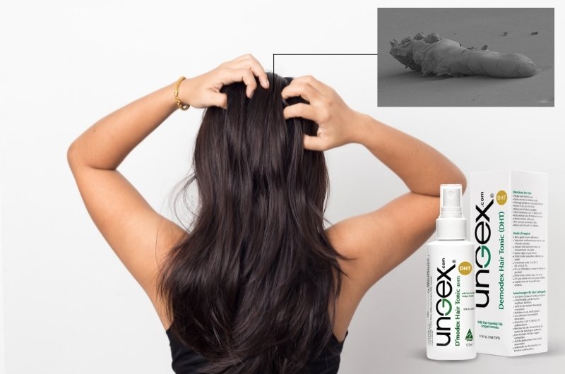 crawling sensation on scalp
