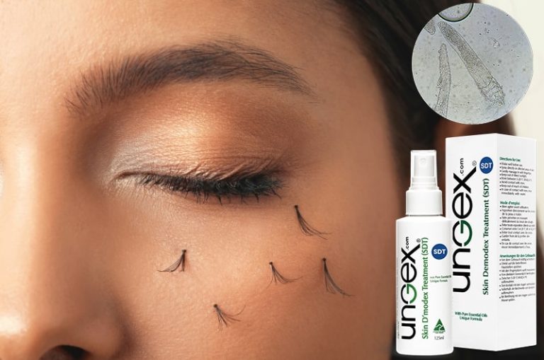 About Demodex Eyelash Mites and Ungex Solution