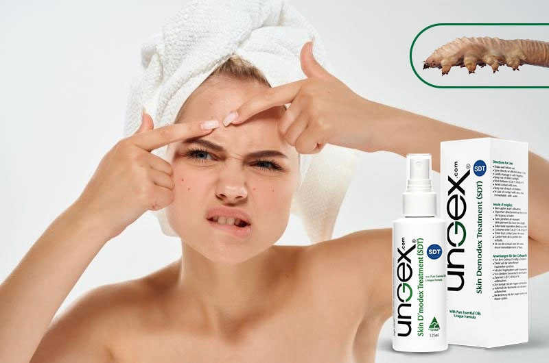acne and pimple