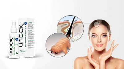 demodex treatment