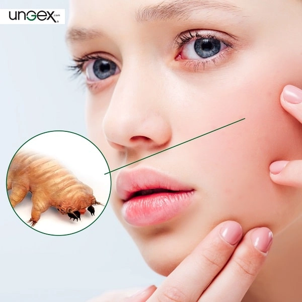Tiring of Demodex | Ungex