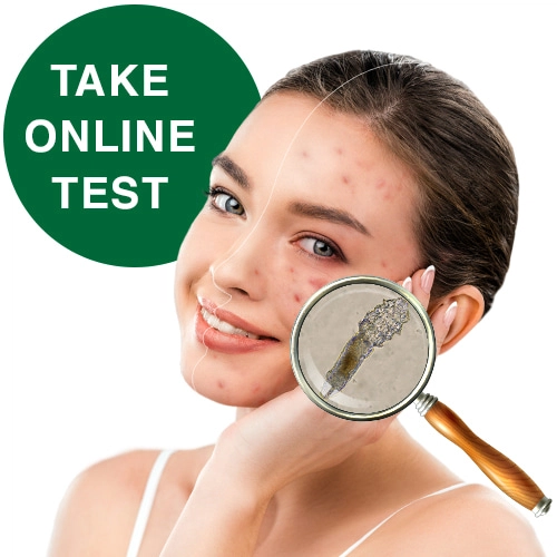 Ungex demodex test