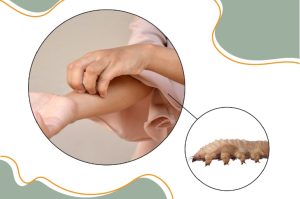 Demodex secrets | Ungex Demodex Treatment