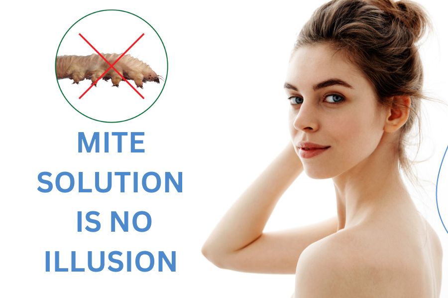 Help Treat Demodex Mites Hair loss, Acne Ungex Products