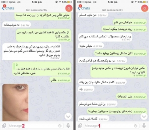 نظرسنجی محصولات ضد دمودکس آنجکس