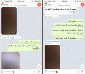نظرسنجی محصولات ضد دمودکس آنجکس