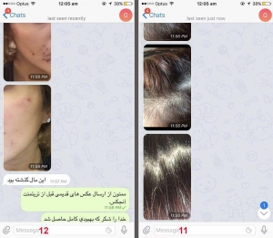 نظرسنجی محصولات ضد دمودکس آنجکس