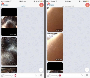 نظرسنجی محصولات ضد دمودکس آنجکس