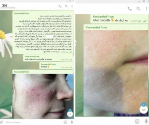 testomonial70
