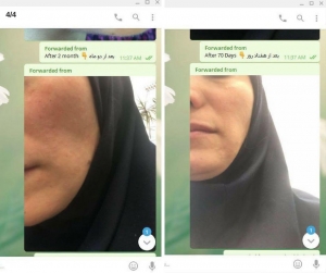 testomonial71