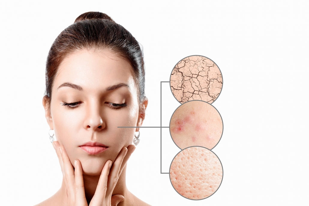 پوست انسان محل زندگی مایت ها | آنجکس