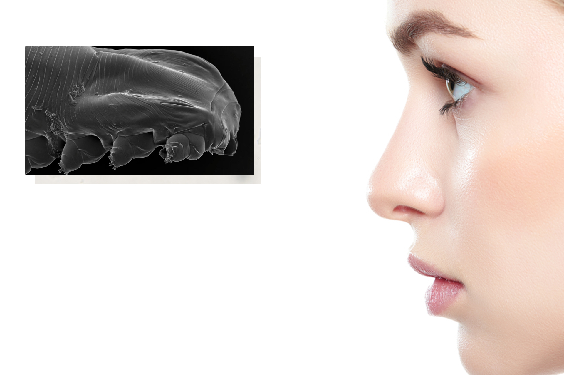 انگل های دمودکس چه می خورند | آنجکس