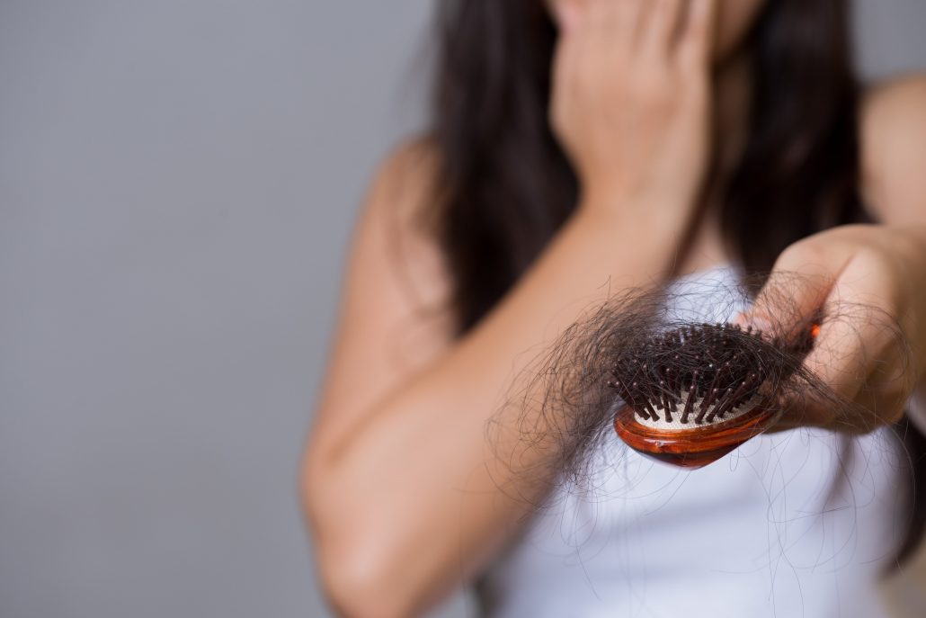 آلوپسی و دمودکس | آنجکس