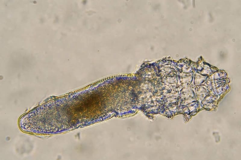 effective baby shampoo to eliminate demodex parasites-ungex