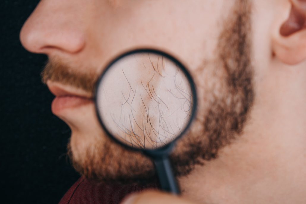 دمودکس برویس | آنجکس