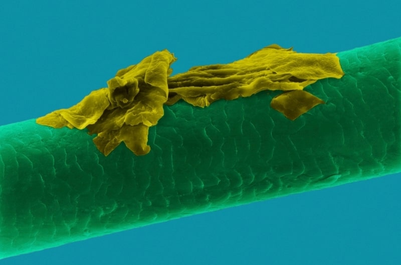 شوره زیر میکروسکوپ