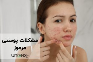 مشکلات پوستی مرموز-آیا واقعاً می‌دانید چه چیزی روی پوست شما می‌خزد