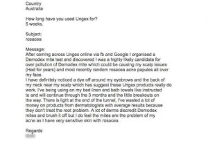 Demodex testimonials | Ungex