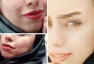Demodex testimonials | Ungex