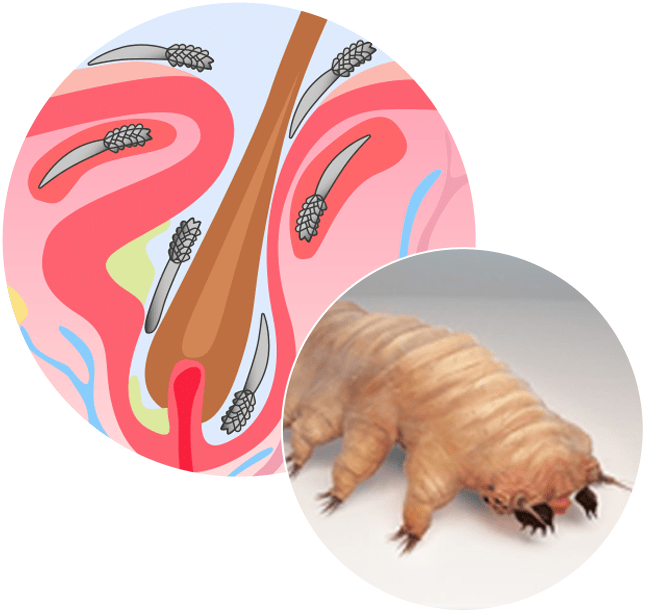 acariens demodex acarien demodex (en anglais) Ungex (Ungex)