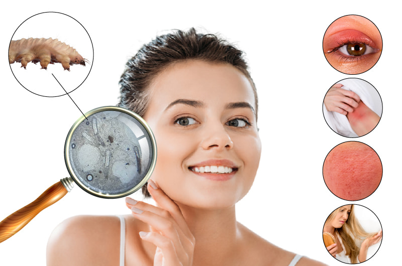 Qu’est-ce que les acariens demodex