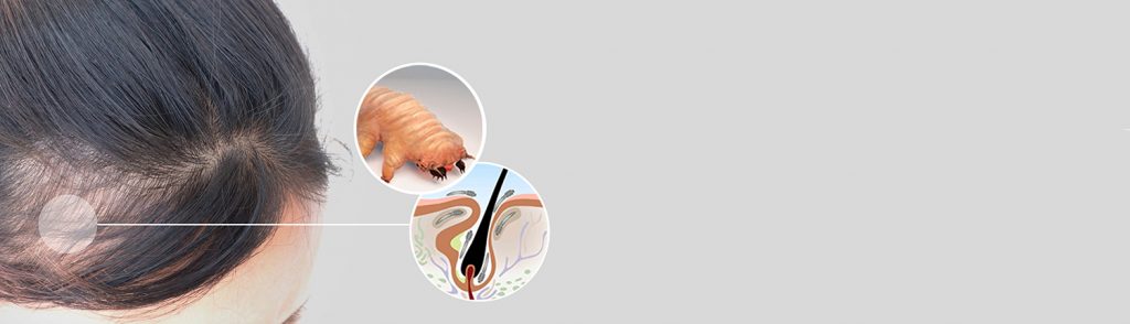 Demodex mites| Ungex