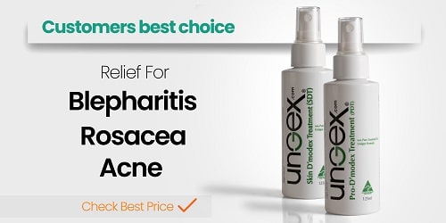 costumers best choice-small Customer Best Choice | Ungex | PDT