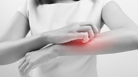 Itching | Ungex