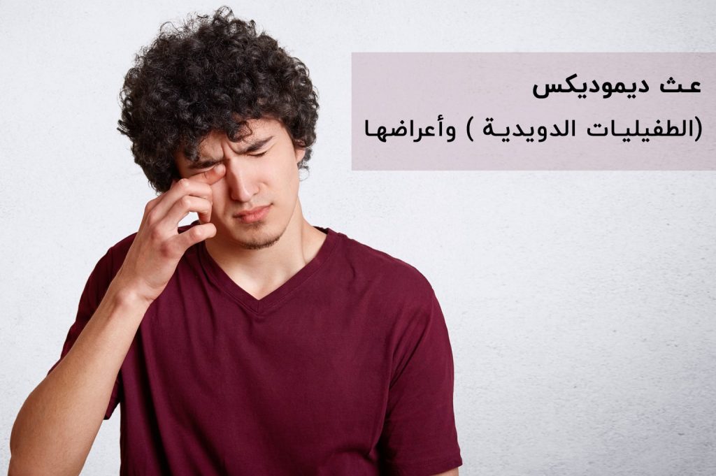 عث ديموديكس (الطفيليات الدويدية ) وأعراضها | انجکس